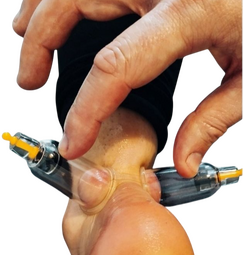 Done using static cups and silicone cups for dynamic. Might leave red circles which dissappear usually within a week.